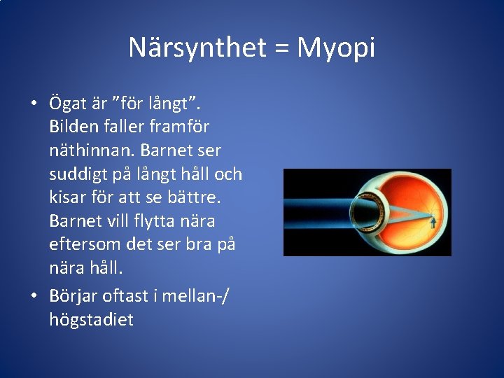 Närsynthet = Myopi • Ögat är ”för långt”. Bilden faller framför näthinnan. Barnet ser