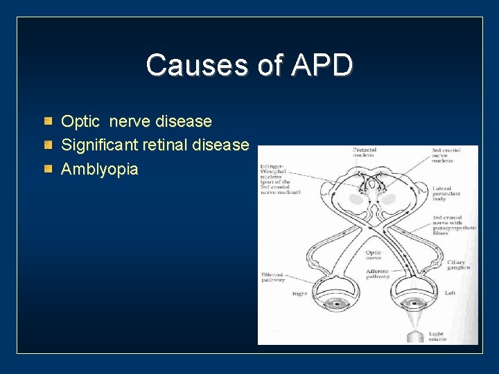 Causes of APD Optic nerve disease Significant retinal disease Amblyopia 