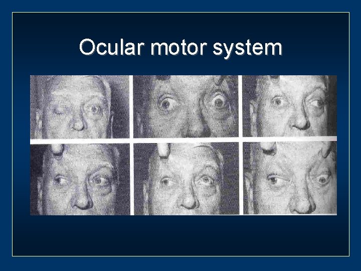 Ocular motor system 
