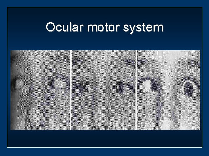 Ocular motor system 