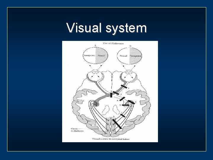 Visual system 