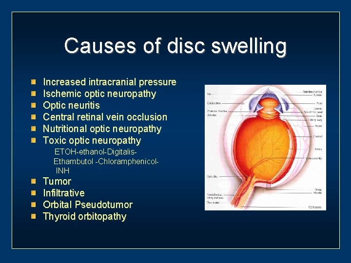 Causes of disc swelling Increased intracranial pressure Ischemic optic neuropathy Optic neuritis Central retinal