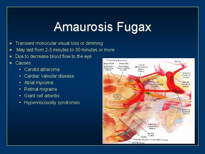 Amaurosis Fugax Transient monocular visual loss or dimming May last from 2 -3 minutes