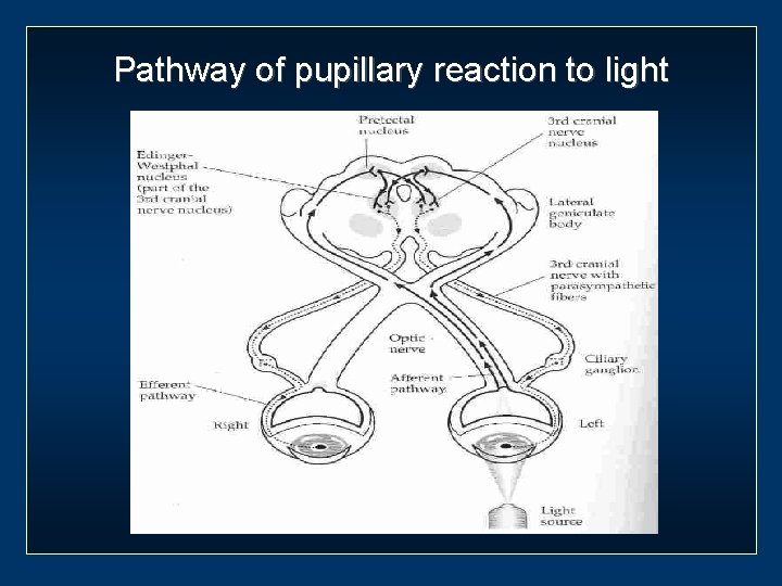 Pathway of pupillary reaction to light 