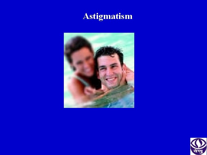 Astigmatism 