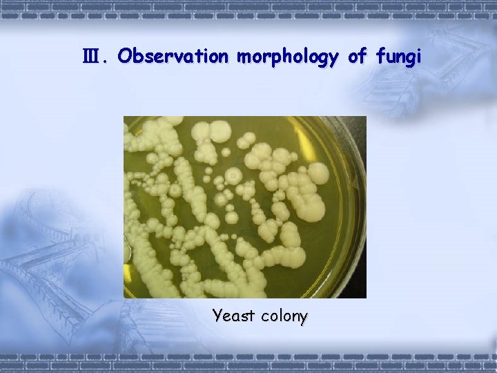 Ⅲ. Observation morphology of fungi Yeast colony 
