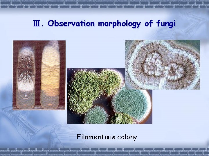 Ⅲ. Observation morphology of fungi Filamentous colony 