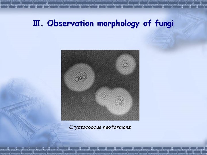 Ⅲ. Observation morphology of fungi Cryptococcus neoformans 