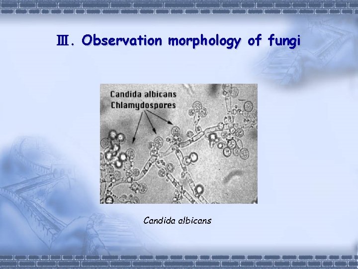 Ⅲ. Observation morphology of fungi Candida albicans 