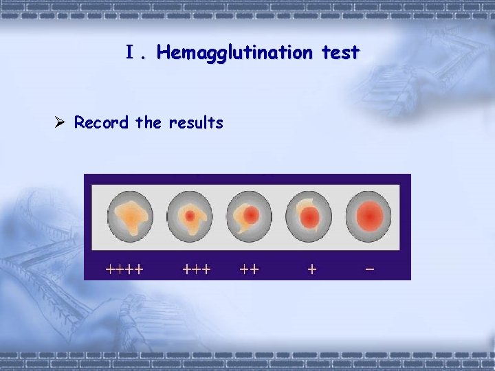 Experiment 1 Hemagglutination test 2 Hemagglutination inhibition test