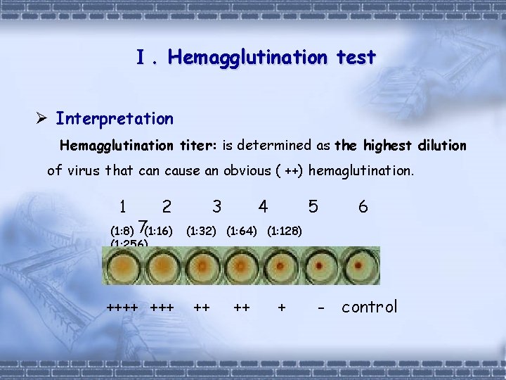 Ⅰ. Hemagglutination test Ø Interpretation Hemagglutination titer: is determined as the highest dilution of