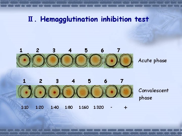 Ⅱ. Hemagglutination inhibition test 1 8 1: 10 2 3 4 5 6 7