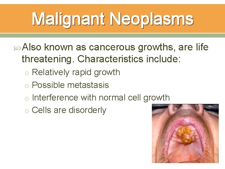 Malignant Neoplasms Also known as cancerous growths, are life threatening. Characteristics include: o Relatively