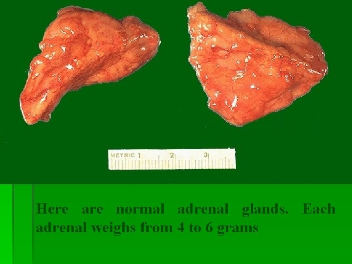 Here are normal adrenal glands. Each adrenal weighs from 4 to 6 grams Here are normal adrenal glands. Each adrenal weighs from 4 to 6 grams