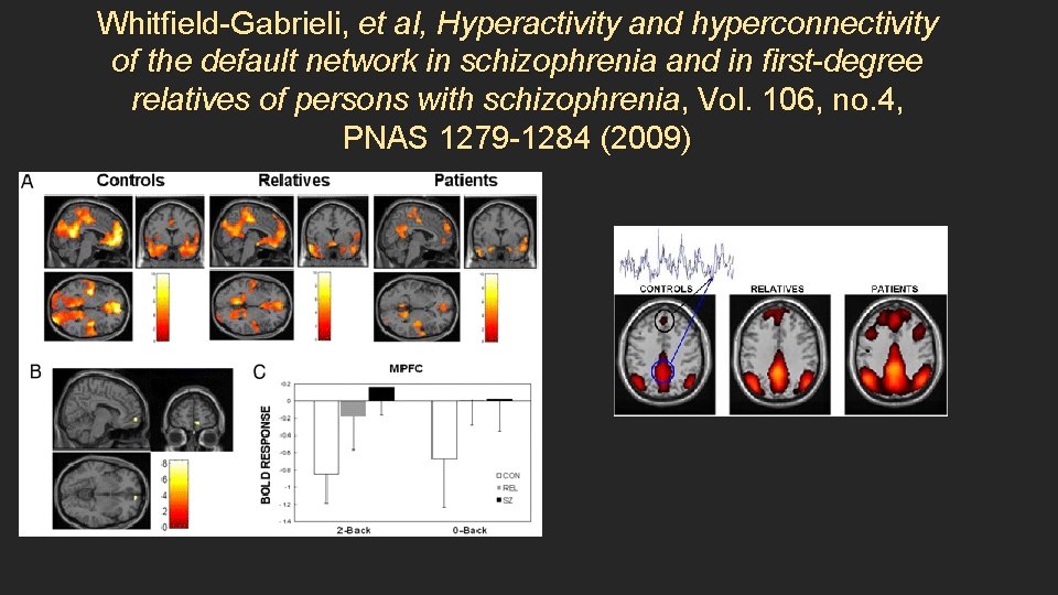 Whitfield-Gabrieli, et al, Hyperactivity and hyperconnectivity of the default network in schizophrenia and in
