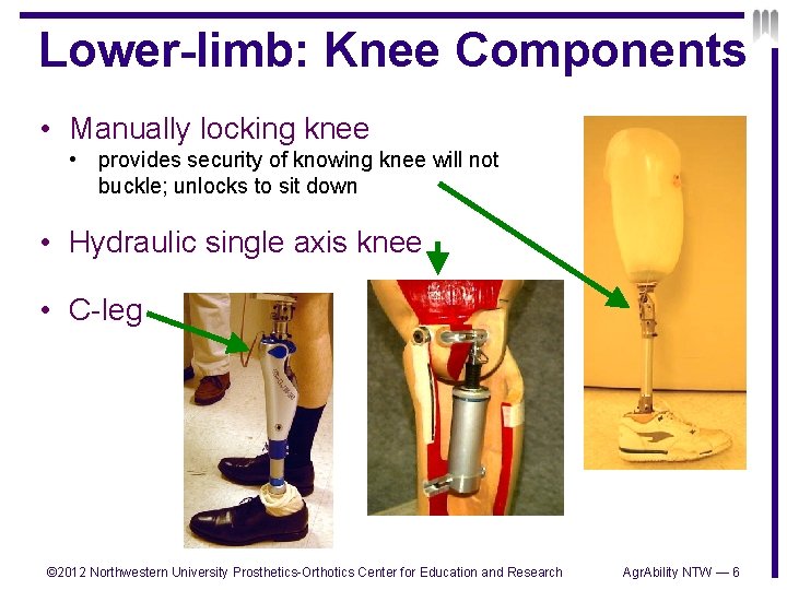 Lower-limb: Knee Components • Manually locking knee • provides security of knowing knee will