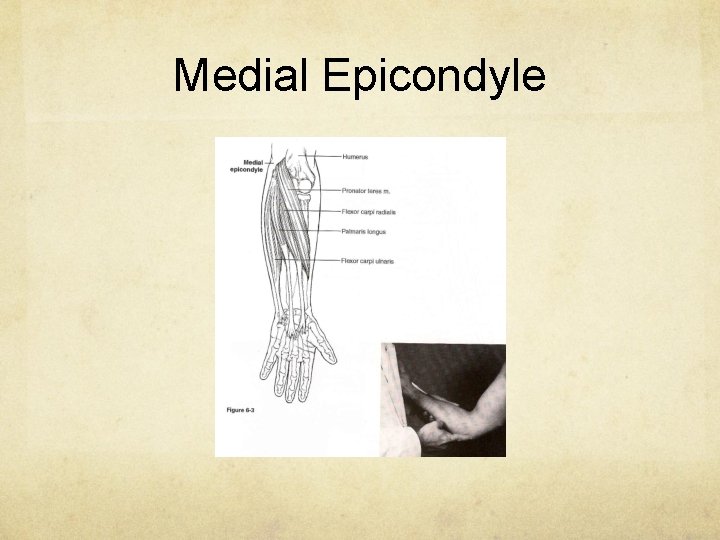 Medial Epicondyle 
