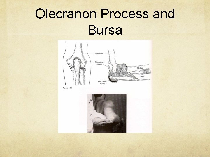 Olecranon Process and Bursa 
