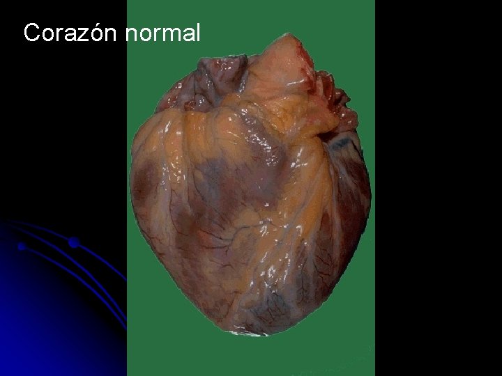 Corazón normal 