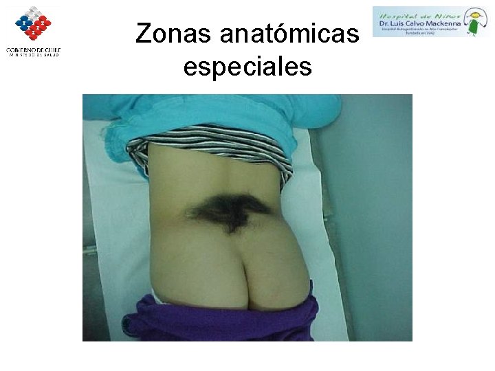 Zonas anatómicas especiales 