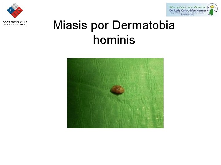 Miasis por Dermatobia hominis 