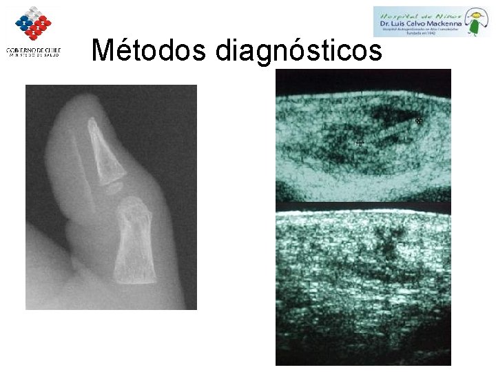 Métodos diagnósticos 