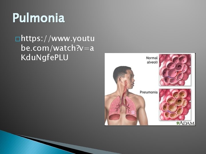 Pulmonia � https: //www. youtu be. com/watch? v=a Kdu. Ngfe. PLU 