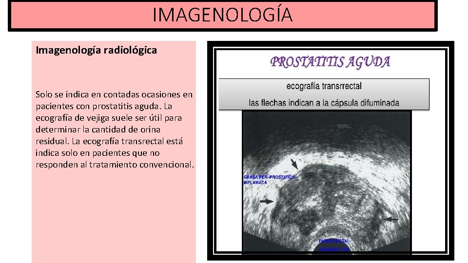 IMAGENOLOGÍA Imagenología radiológica Solo se indica en contadas ocasiones en pacientes con prostatitis aguda.