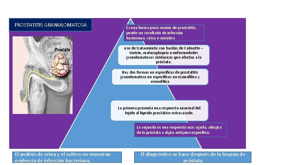 PROSTATITIS GRANULOMATOSA Es una forma poco común de prostatitis, puede ser resultado de infección