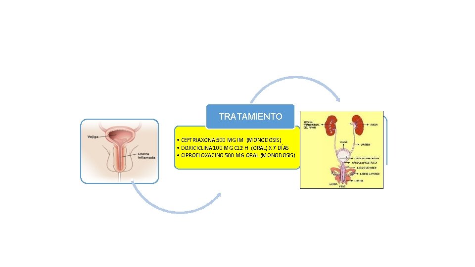 TRATAMIENTO • CEFTRIAXONA: 500 MG IM (MONODOSIS) • DOXICICLINA 100 MG C 12 H