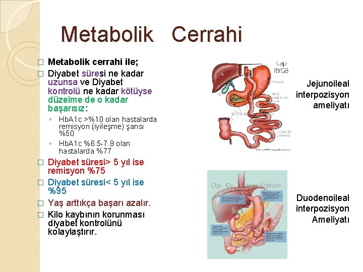 Metabolik Cerrahi Metabolik cerrahi ile; � Diyabet süresi ne kadar uzunsa ve Diyabet kontrolü