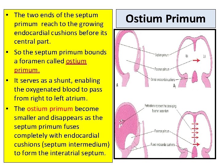  • The two ends of the septum primum reach to the growing endocardial