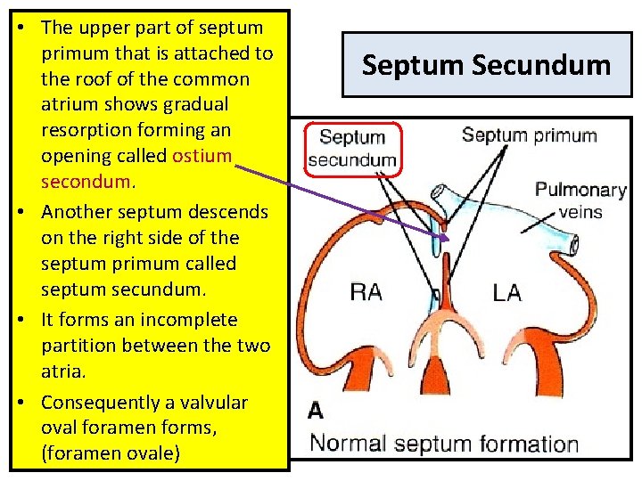  • The upper part of septum primum that is attached to the roof
