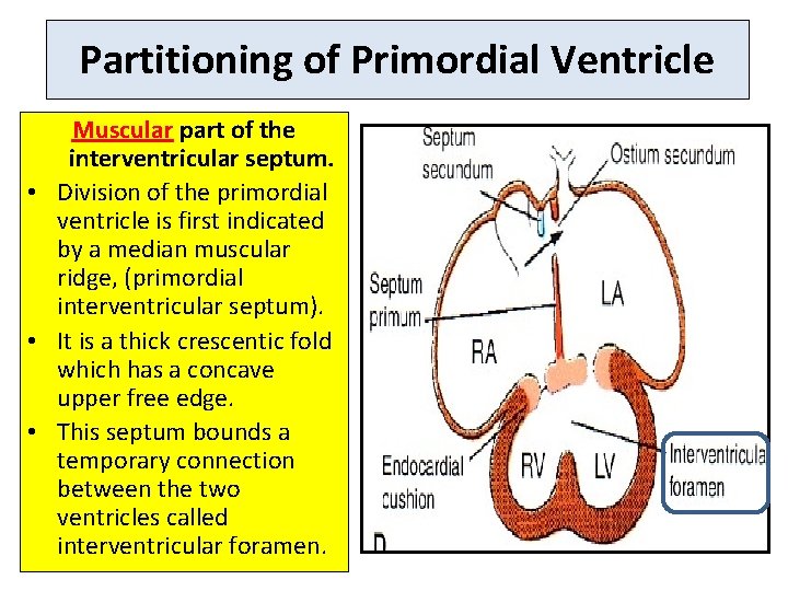 Partitioning of Primordial Ventricle Muscular part of the interventricular septum. • Division of the