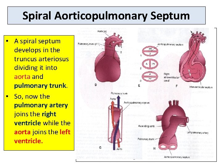 Spiral Aorticopulmonary Septum • A spiral septum develops in the truncus arteriosus dividing it
