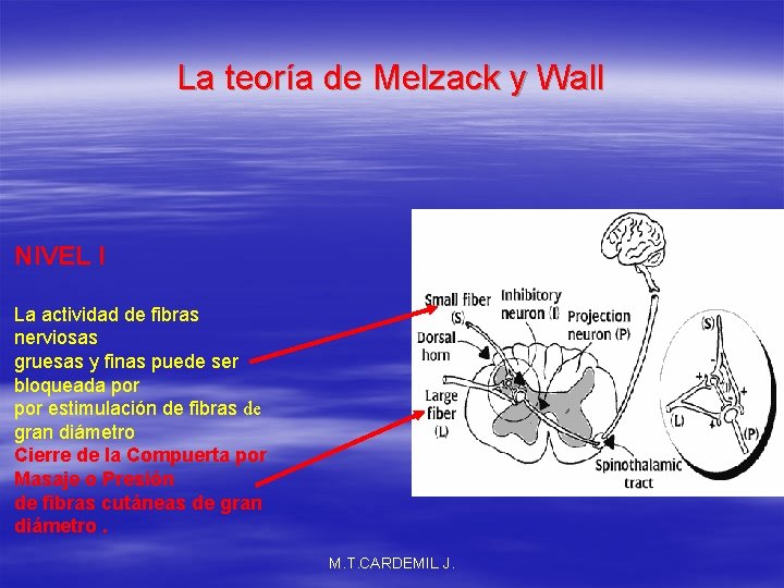 La teoría de Melzack y Wall NIVEL I La actividad de fibras nerviosas gruesas
