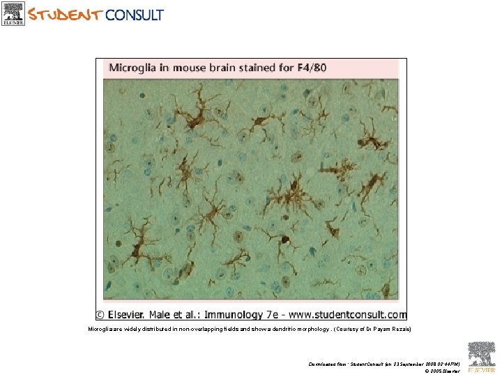 Microglia are widely distributed in non-overlapping fields and show a dendritic morphology. (Courtesy of