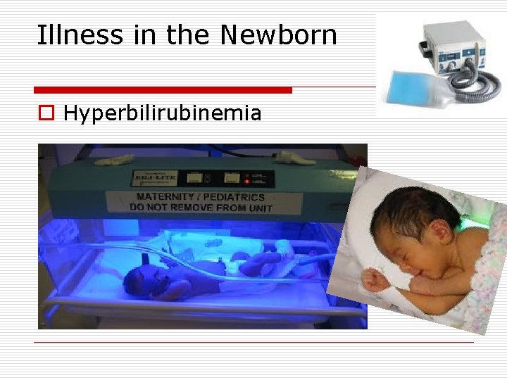 Illness in the Newborn o Hyperbilirubinemia 