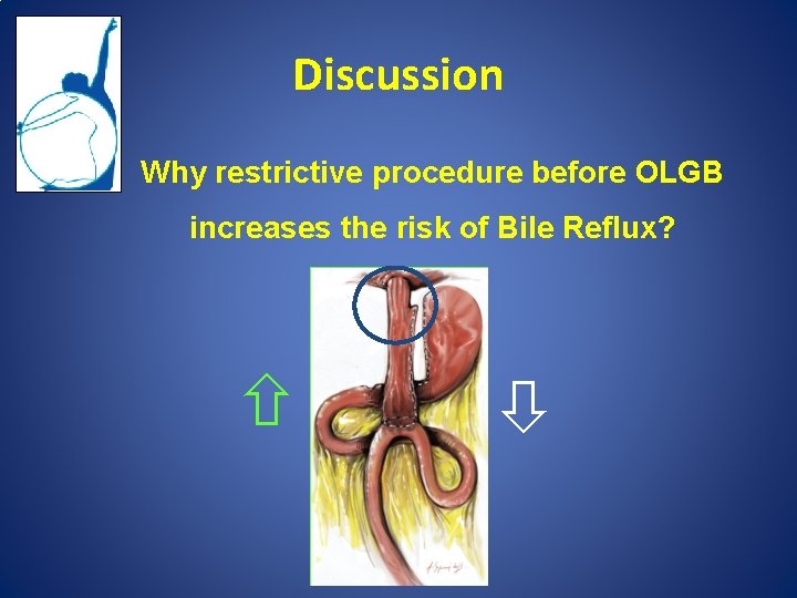 Discussion Why restrictive procedure before OLGB increases the risk of Bile Reflux? 