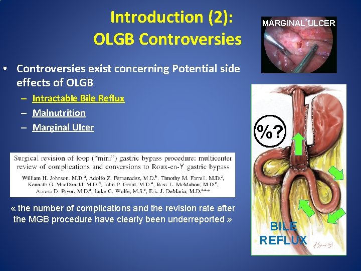 Introduction (2): OLGB Controversies MARGINAL ULCER • Controversies exist concerning Potential side effects of