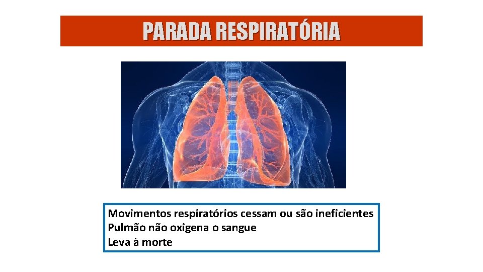 PARADA RESPIRATÓRIA Movimentos respiratórios cessam ou são ineficientes Pulmão não oxigena o sangue Leva