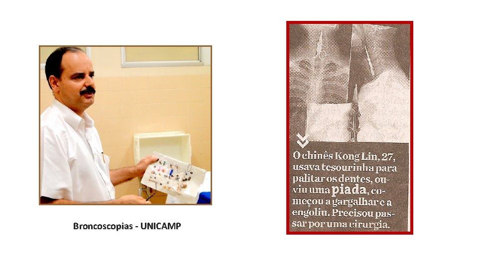 Broncoscopias - UNICAMP 