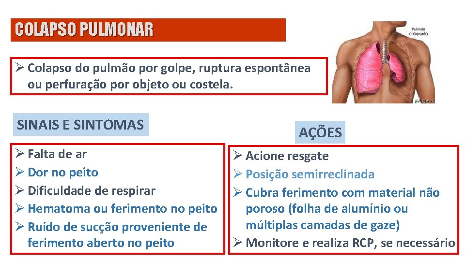 COLAPSO PULMONAR Ø Colapso do pulmão por golpe, ruptura espontânea ou perfuração por objeto