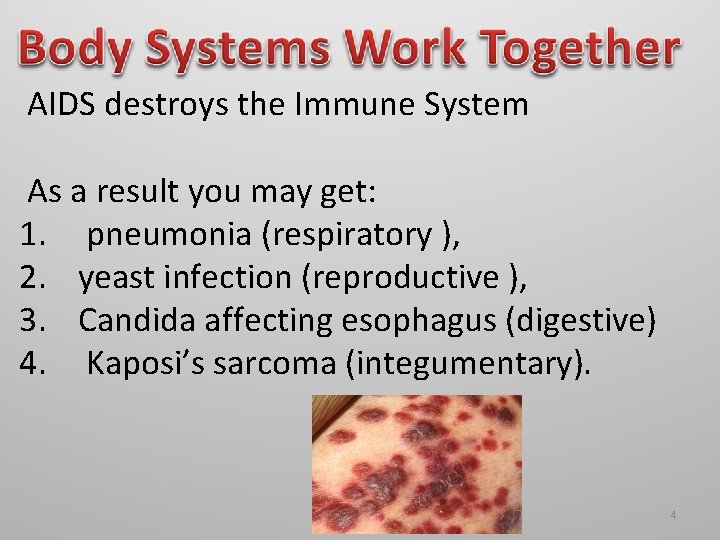  AIDS destroys the Immune System As a result you may get: 1. pneumonia