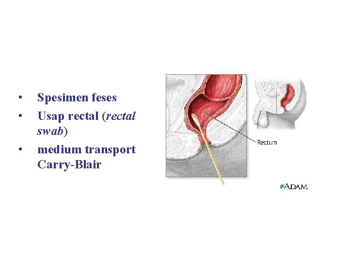SPESIMEN SALURAN CERNA • • • Spesimen feses Usap rectal (rectal swab) medium transport