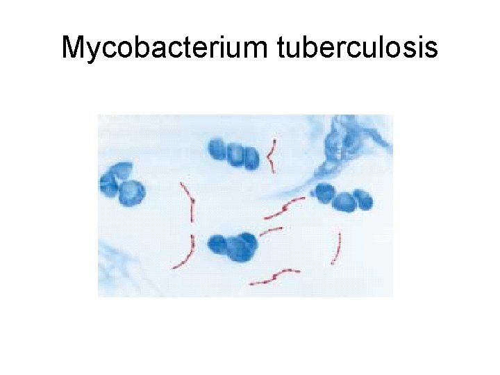 Mycobacterium tuberculosis 