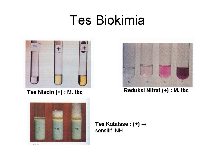 Tes Biokimia Tes Niacin (+) : M. tbc Reduksi Nitrat (+) : M. tbc