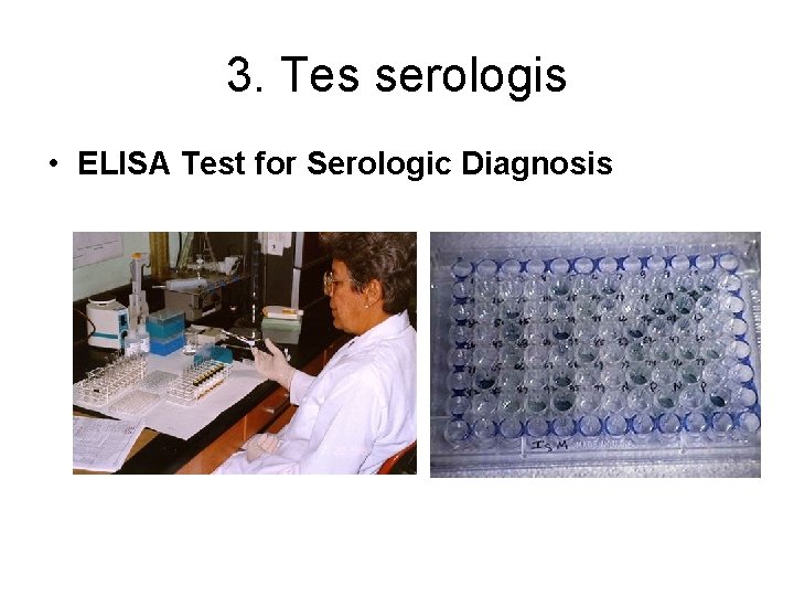 3. Tes serologis • ELISA Test for Serologic Diagnosis 