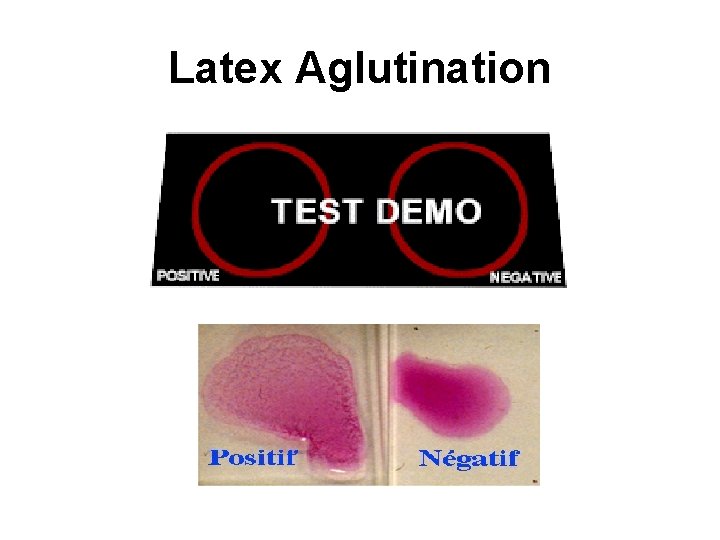 Latex Aglutination 