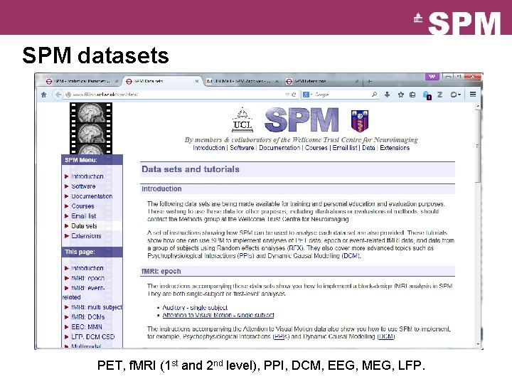 SPM datasets PET, f. MRI (1 st and 2 nd level), PPI, DCM, EEG,